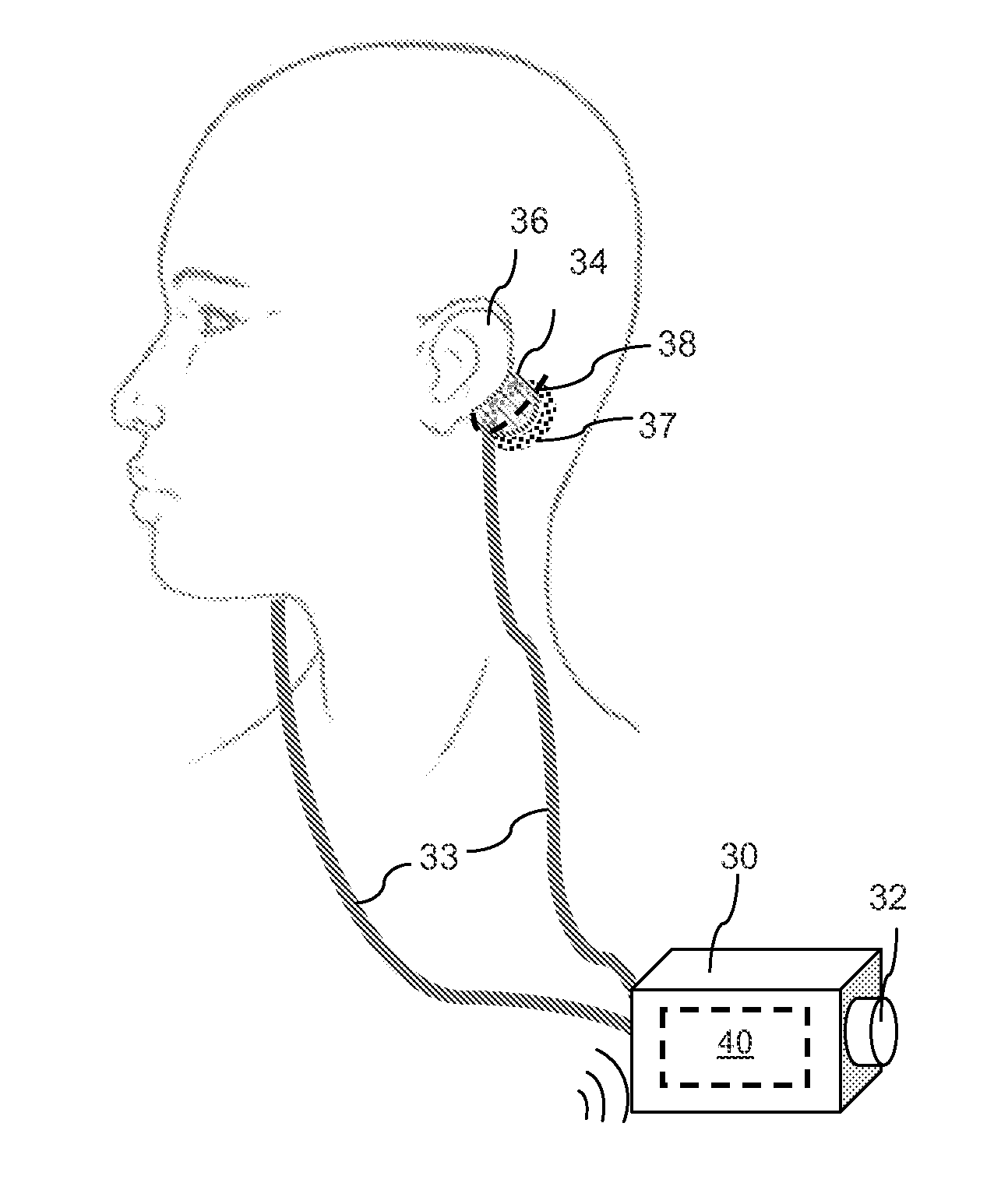 Method and system for altering body mass composition using galvanic vestibular stimulation