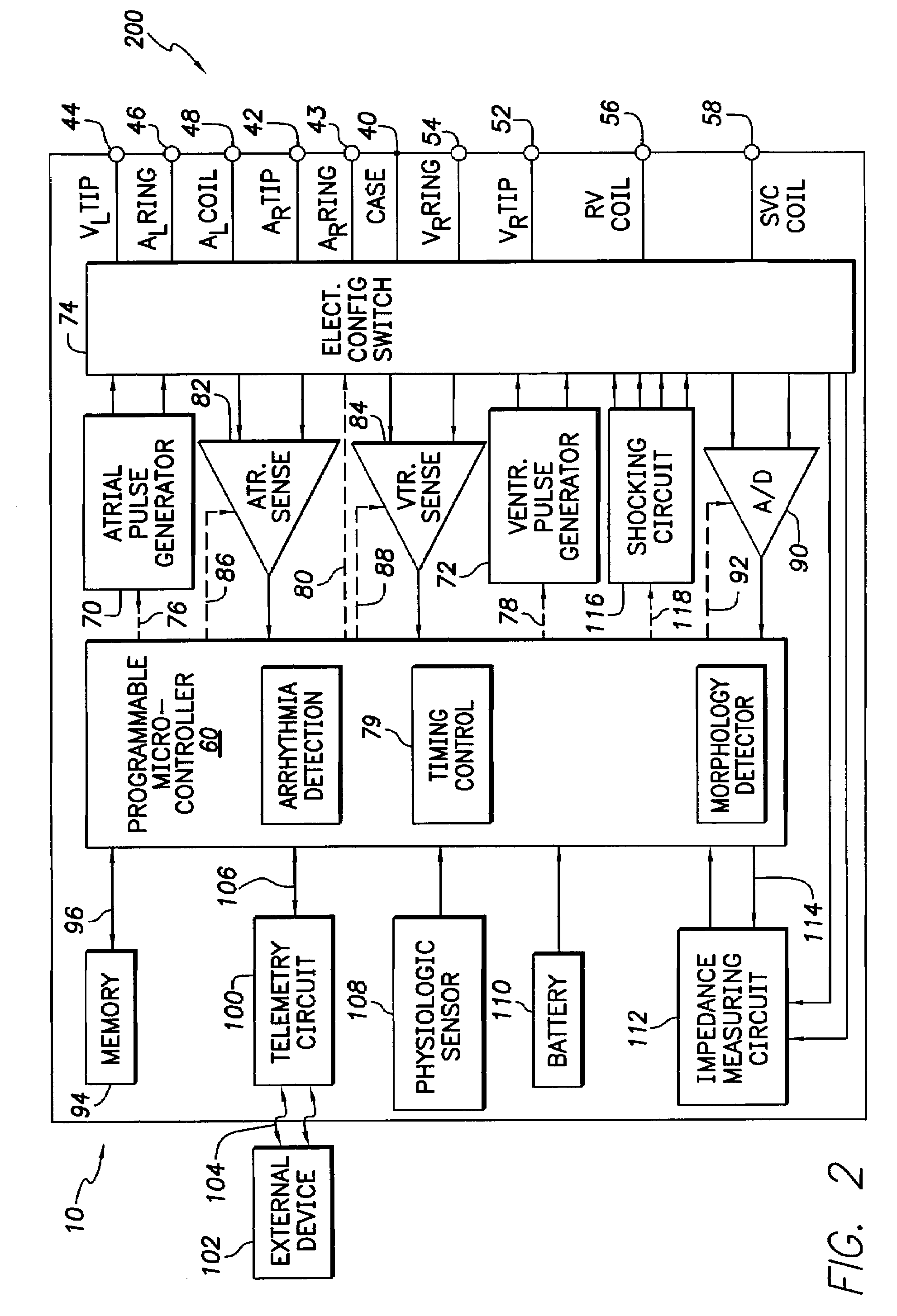 Physician programmer system with telemetered sensor waveform