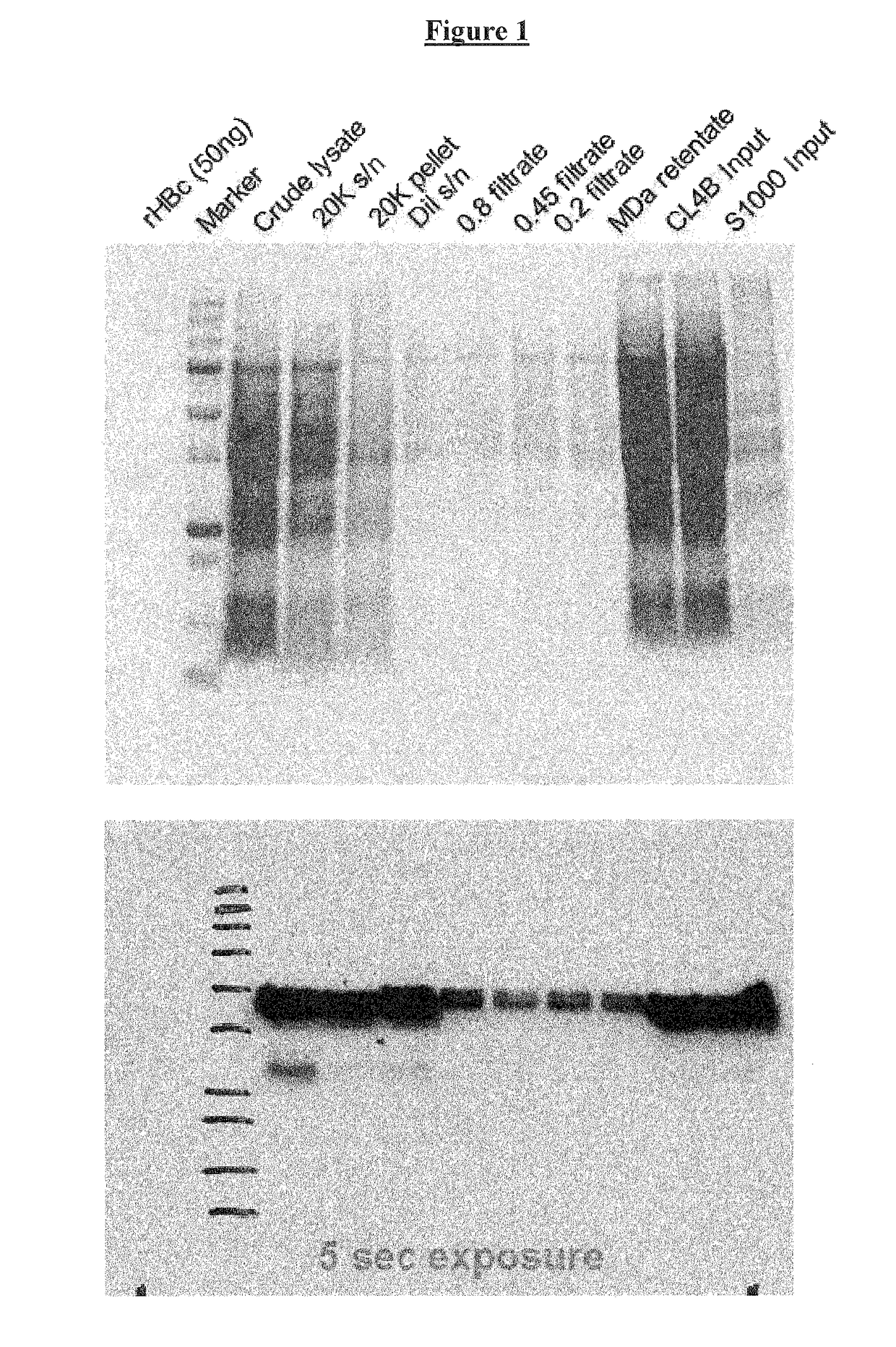 Vaccines based on hepatitis B core antigens