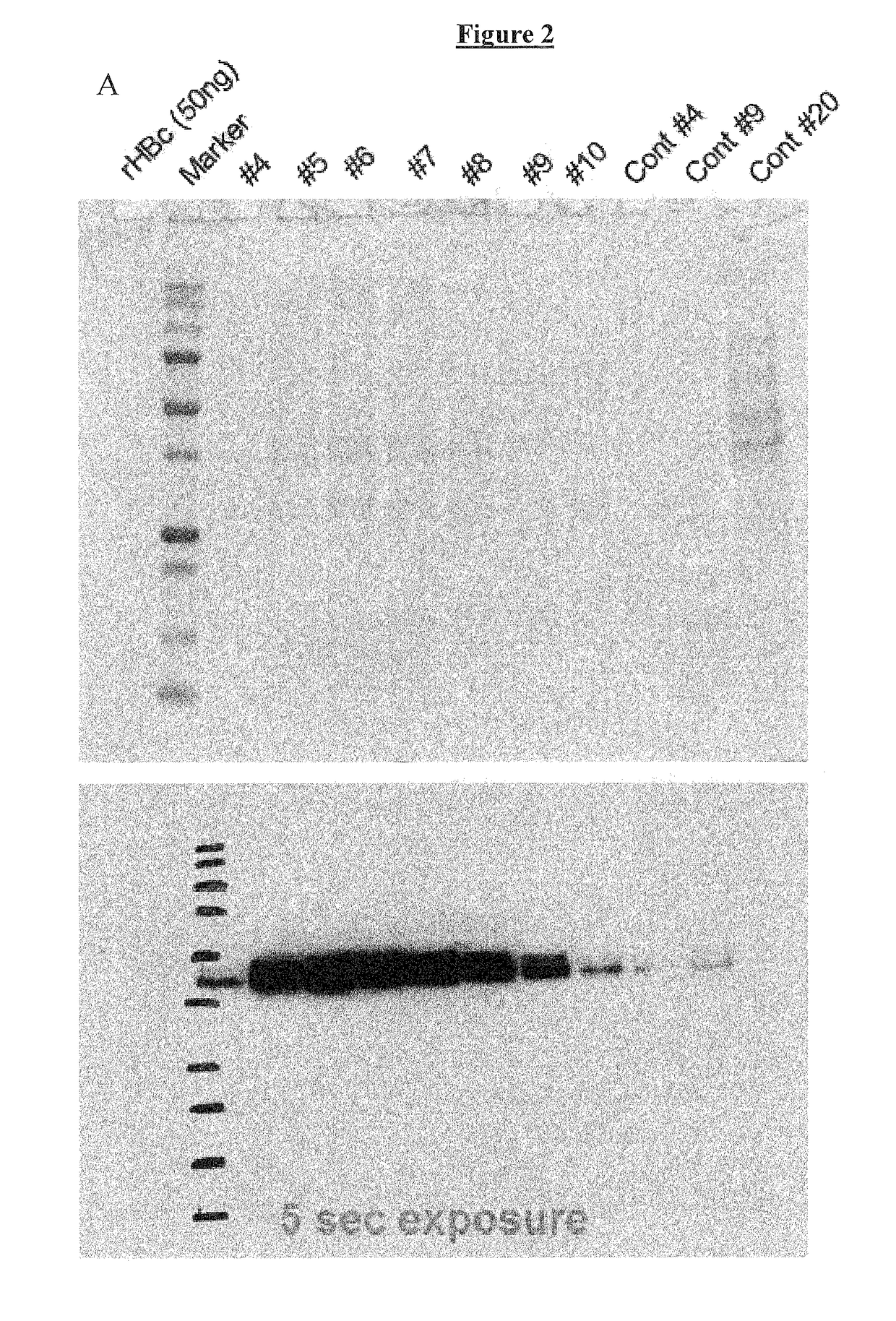 Vaccines based on hepatitis B core antigens