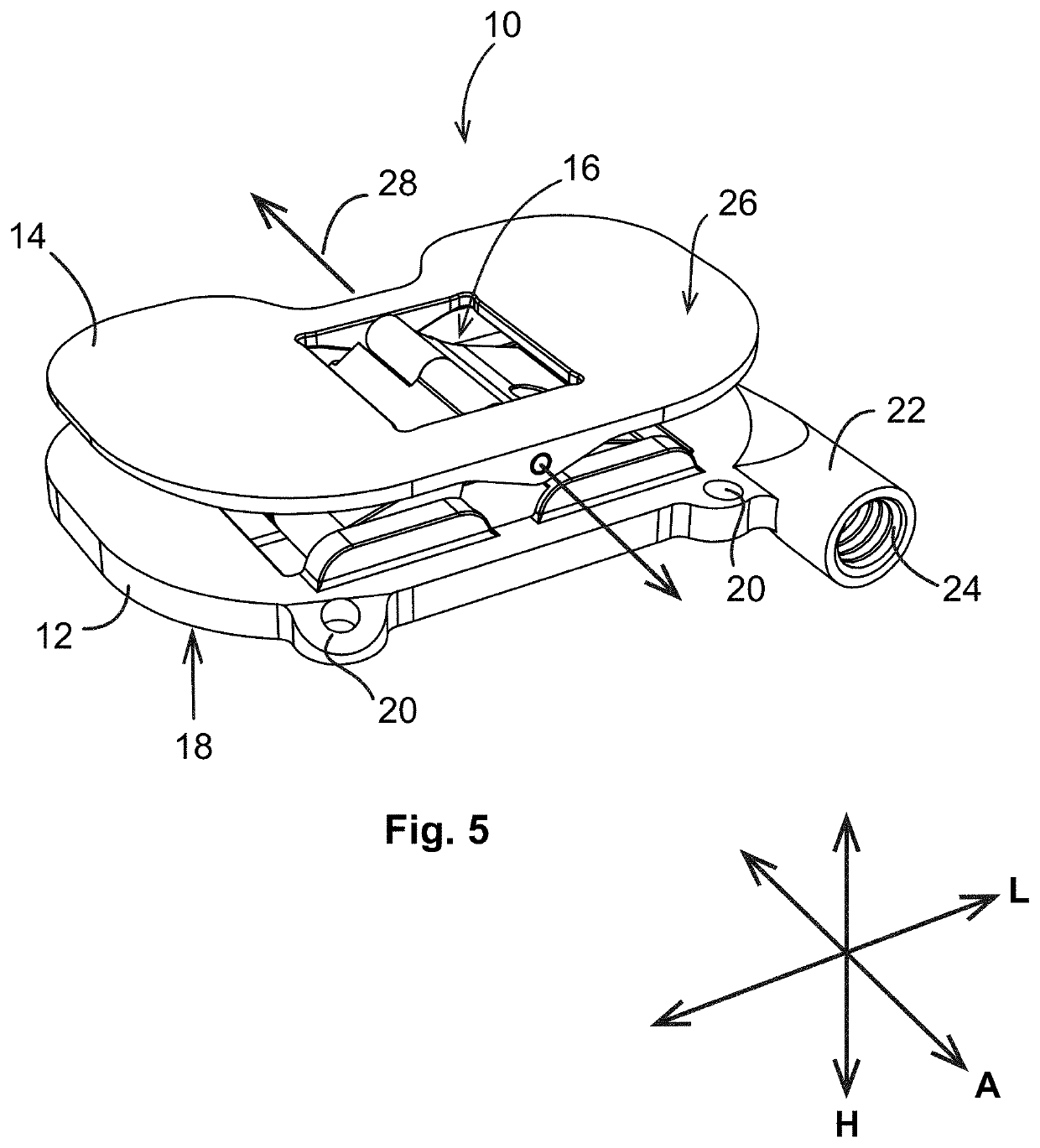 Knee flexion and extension gap tensioning and measuring method