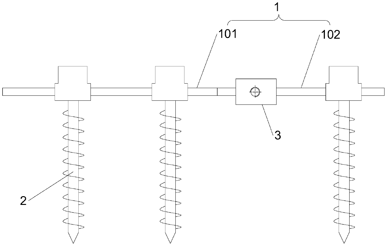 Severe lumbar spondylolisthesis reduction fixing device