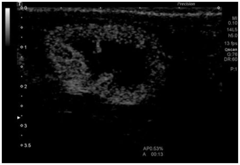 A kind of ultrasonic contrast agent and preparation method thereof