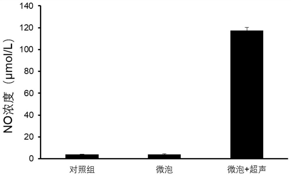 A kind of ultrasonic contrast agent and preparation method thereof