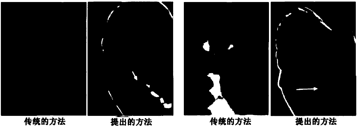 Breath tracking method based on thermal imaging technology