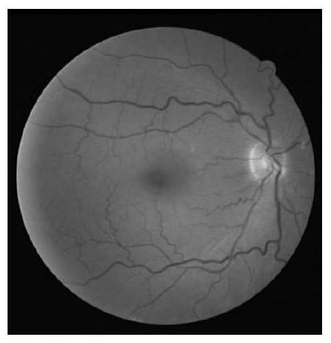 Iterative Fundus Image Vessel Segmentation Method Based on Range Modulation Loss