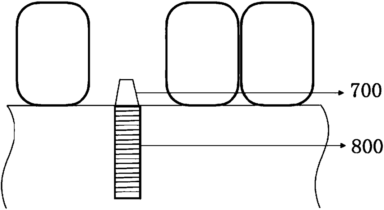 Autonomous dental implant robot system, device and method thereof