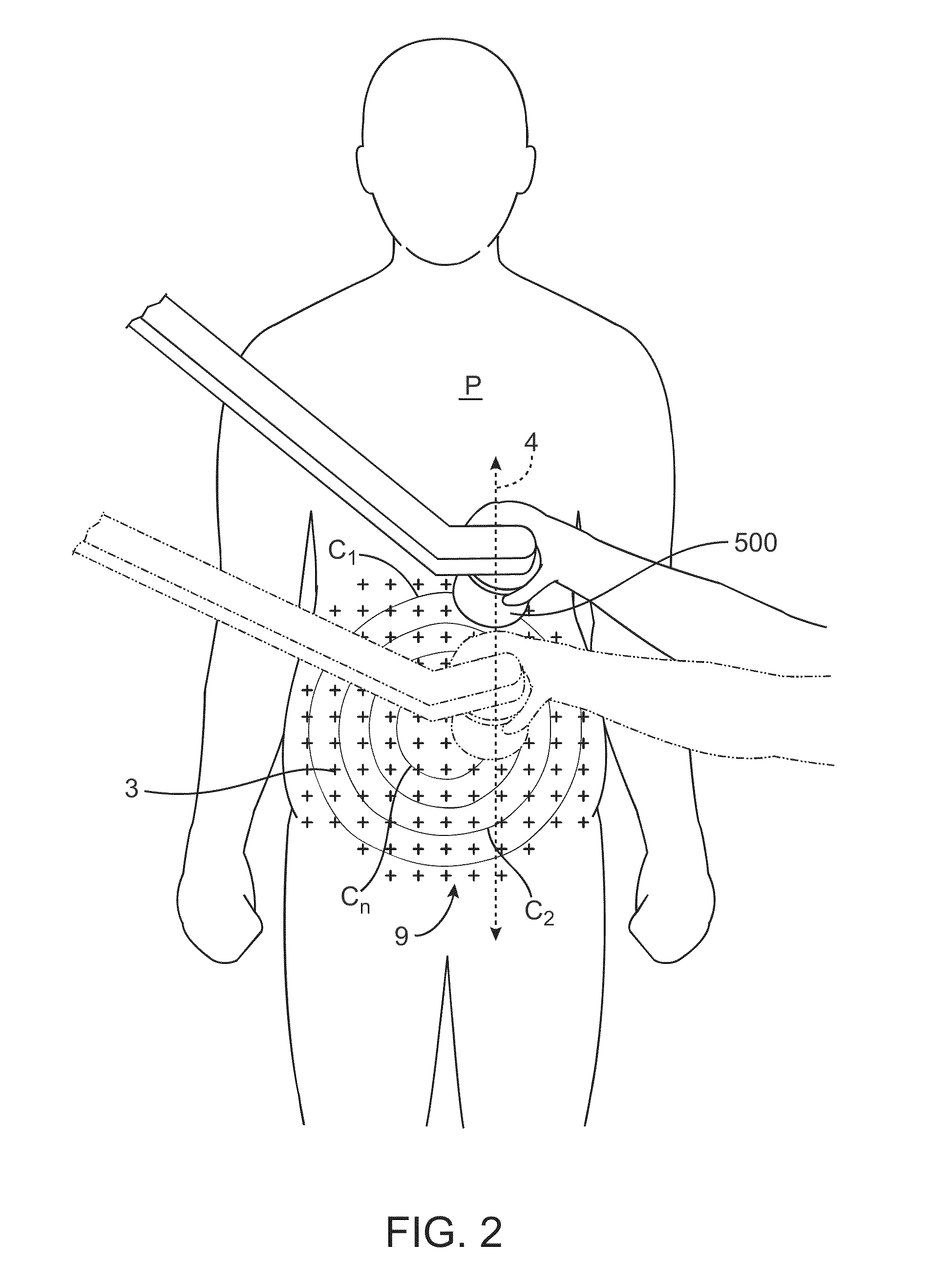 Apparatus and methods for the destruction of adipose tissue