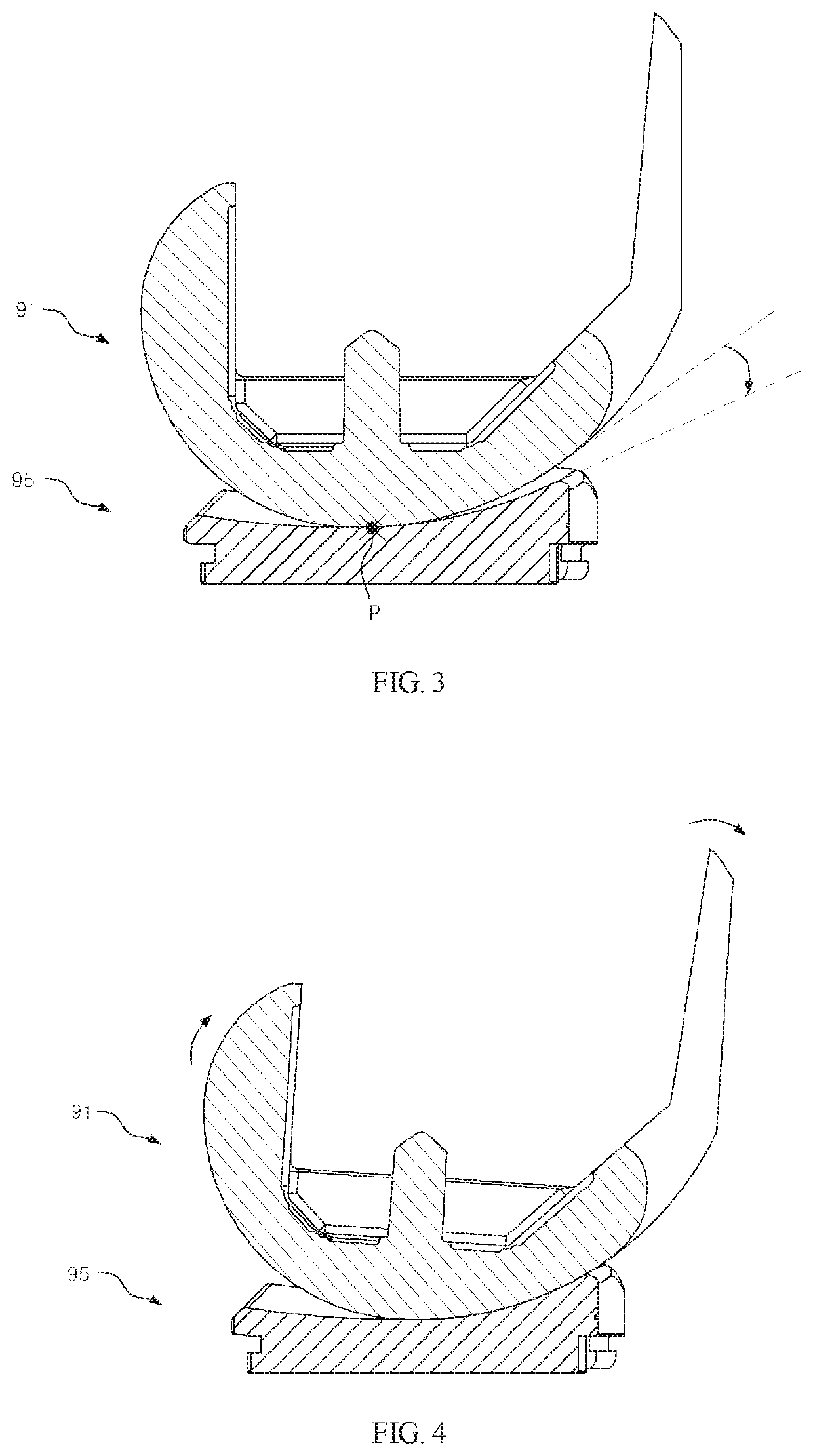 Knee joint implant preventing hyperextension