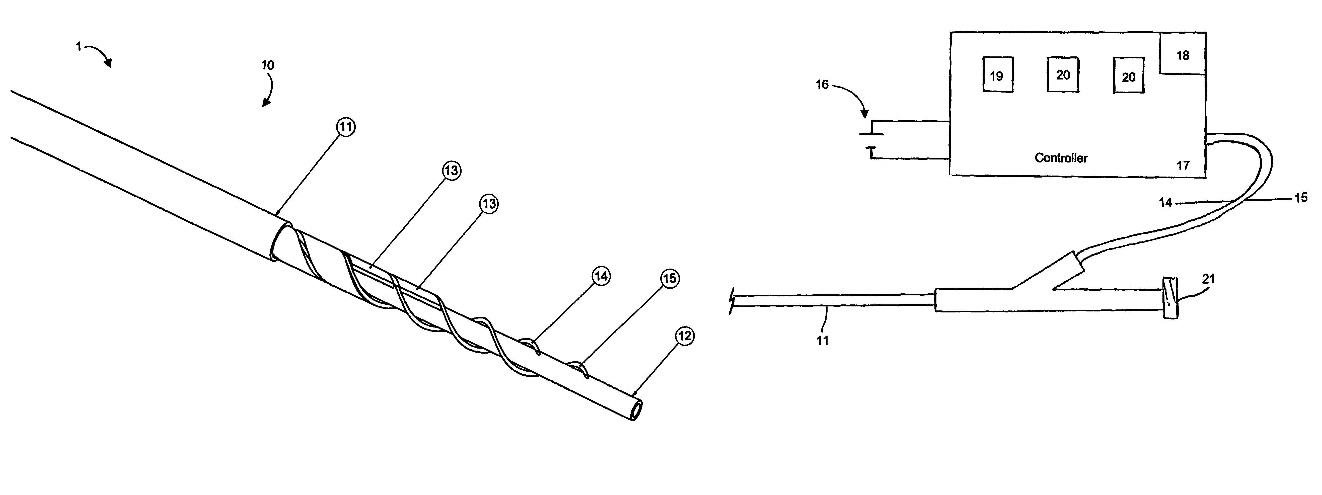 Catheter with controllable stiffness and method for operating a selective stiffening catheter