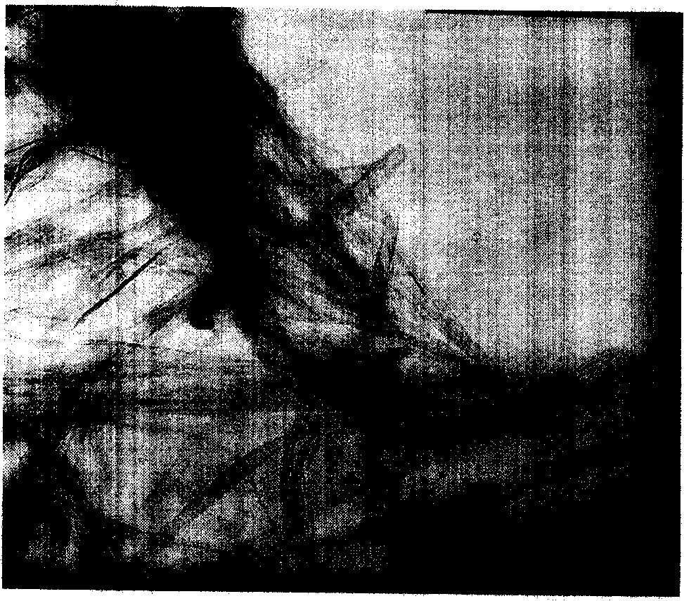 Method for preparing nano-tubular sodium titanate/titanci acid