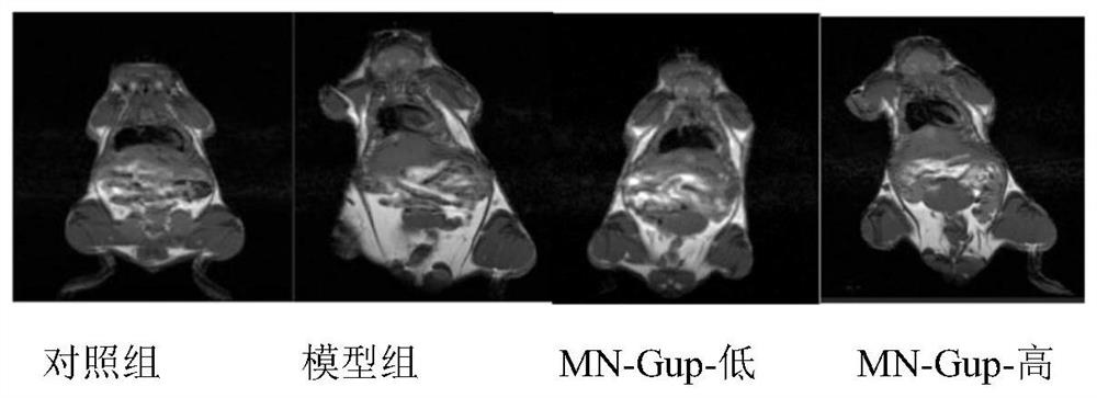 Application of bifidobacterium lactis MN-Gup in improvement of obesity and characteristic intestinal flora thereof