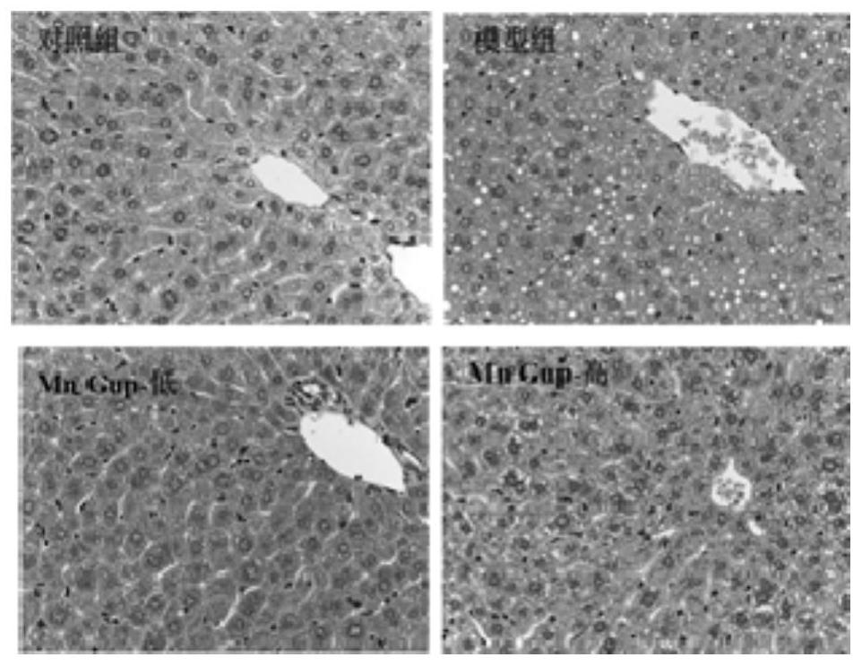 Application of bifidobacterium lactis MN-Gup in improvement of obesity and characteristic intestinal flora thereof