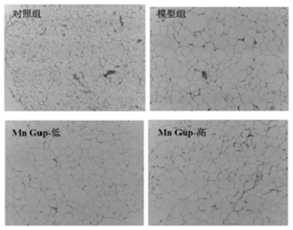 Application of bifidobacterium lactis MN-Gup in improvement of obesity and characteristic intestinal flora thereof