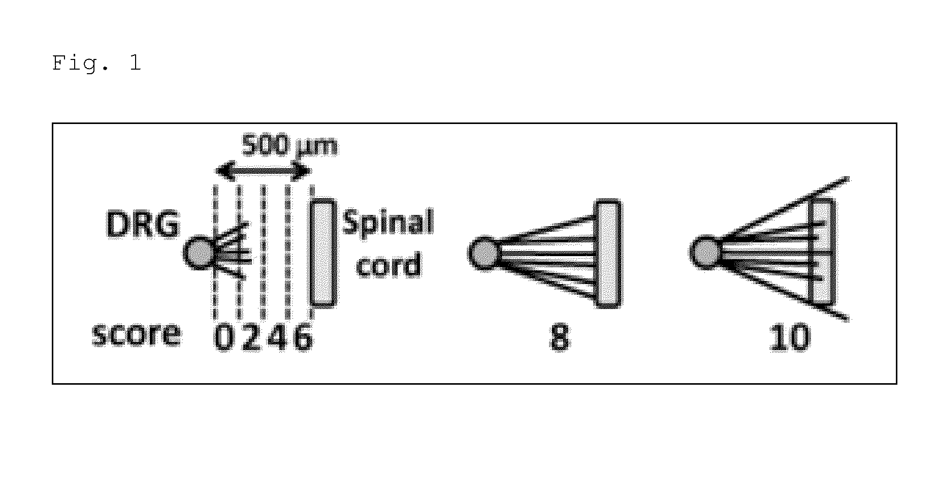 Antibody binding to lysophosphatidylglucoside, and composition comprising the same