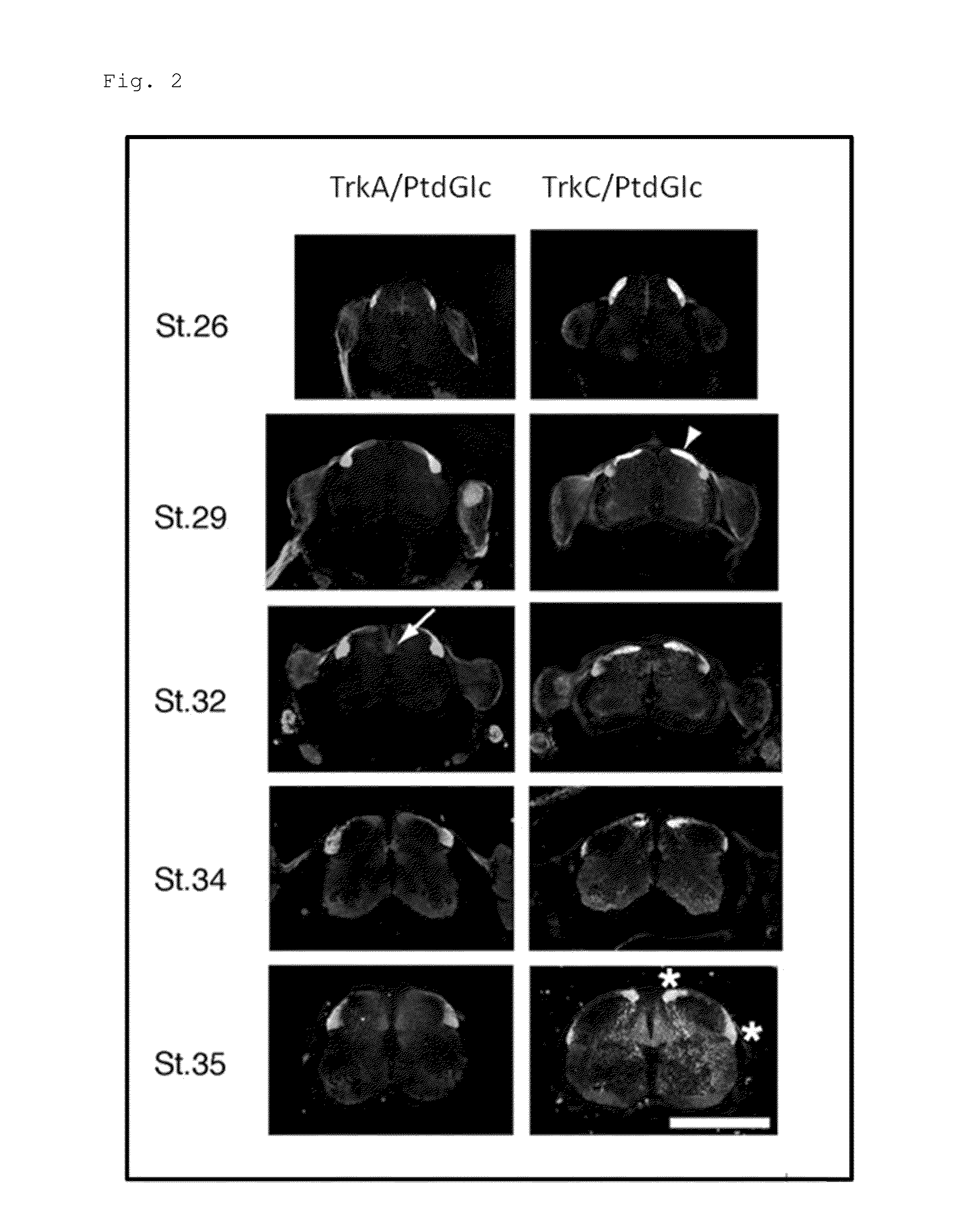 Antibody binding to lysophosphatidylglucoside, and composition comprising the same