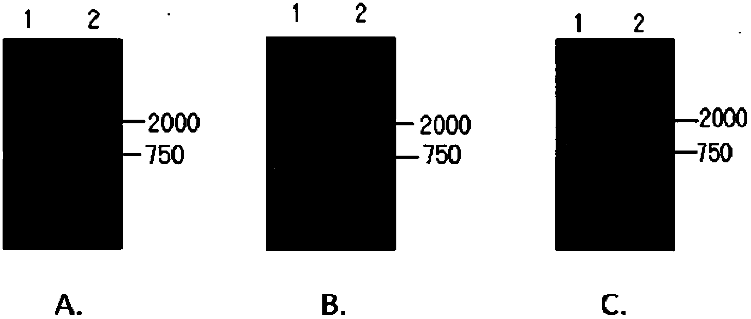 Microballoon with immobilized presented immune co-stimulation molecules and preparation method of microballoon