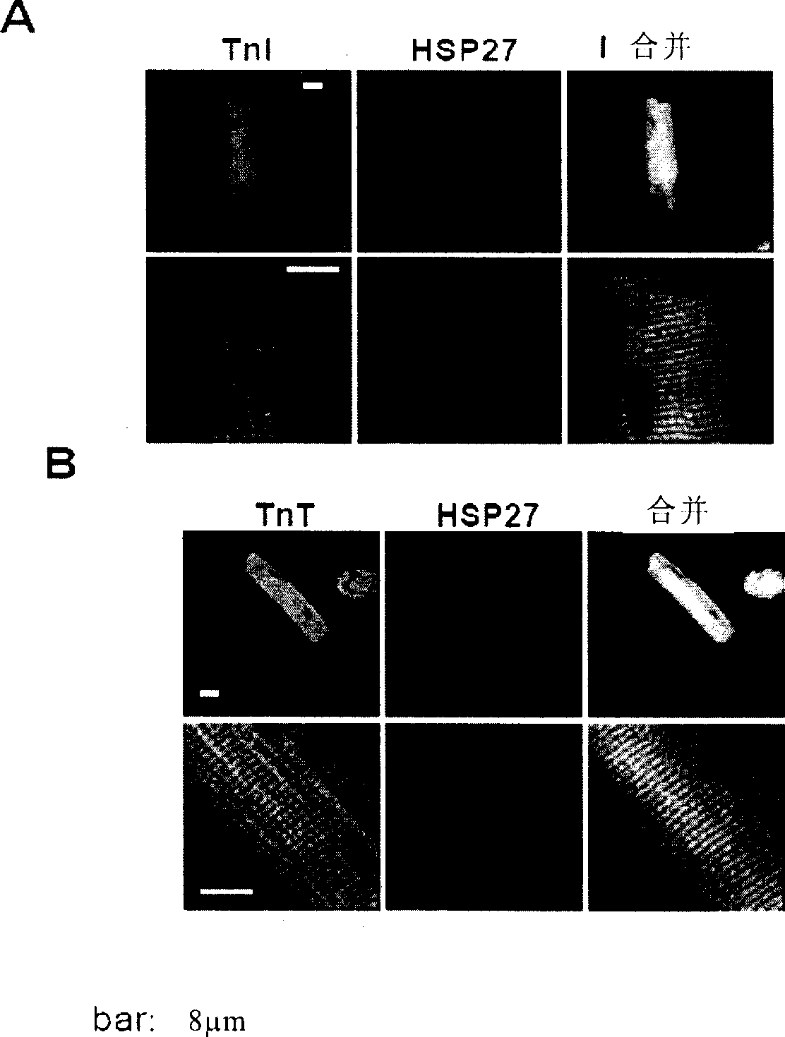 Application of HSP27 in aspect for improving post-ischemic cardiac systolic function