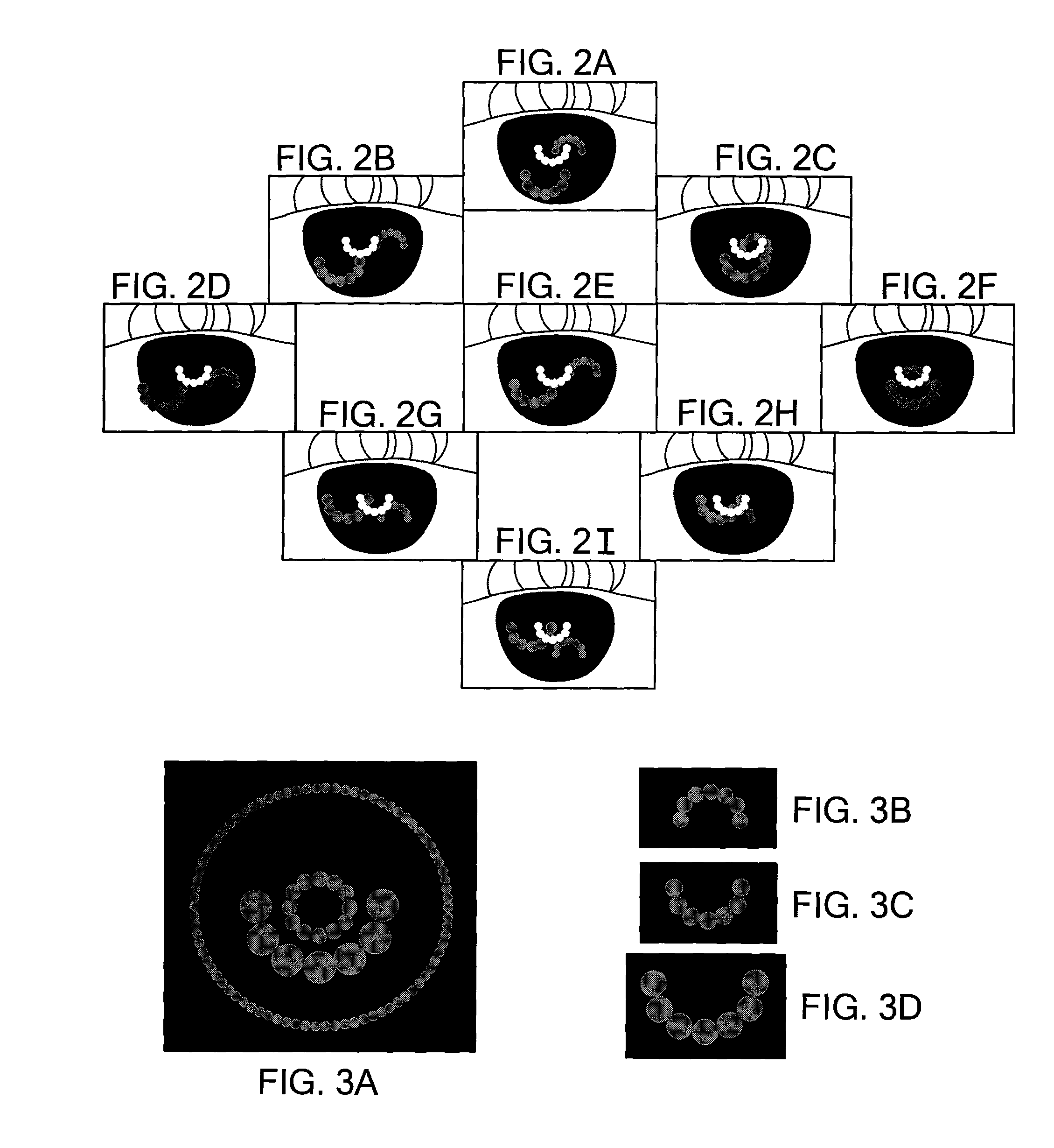 Purkinjie image-based alignment of suction ring in ophthalmic applications