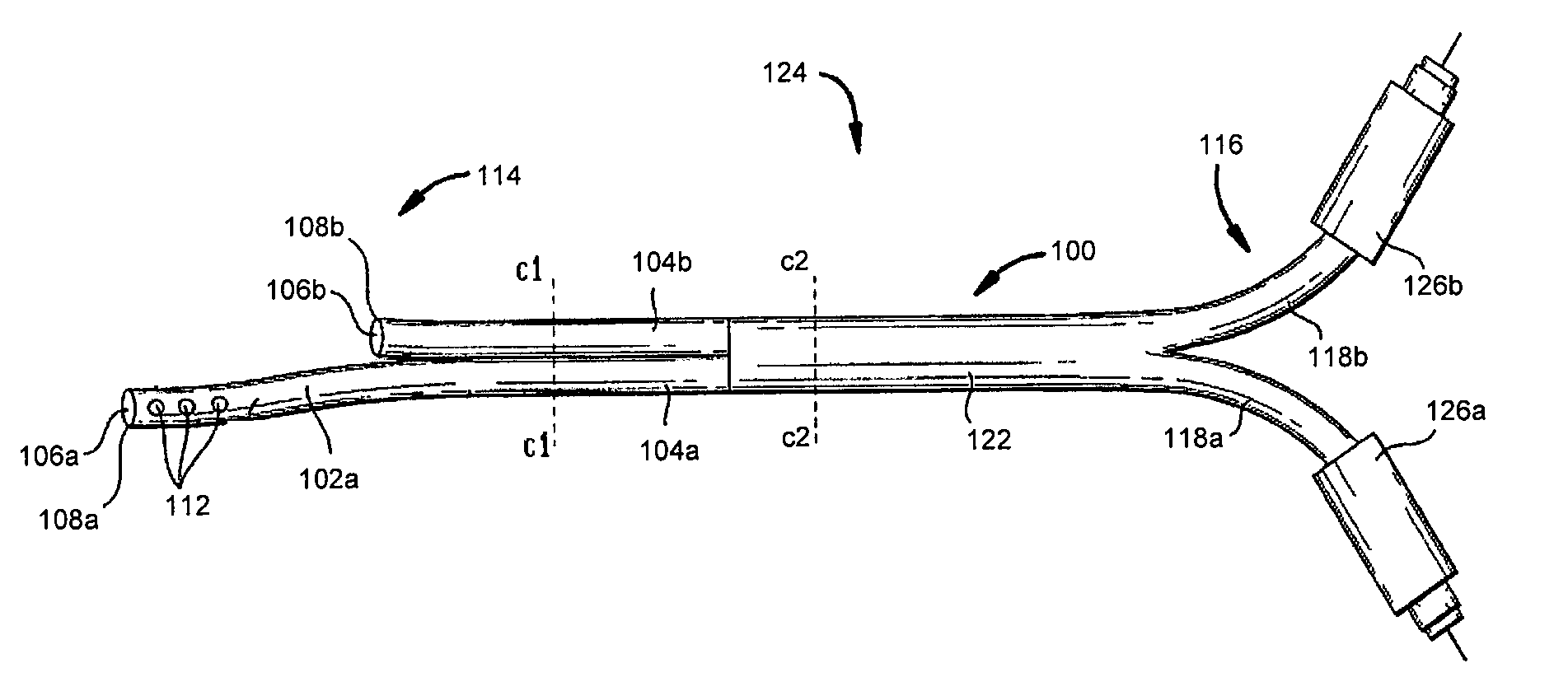 Catheters with enlarged arterial lumens