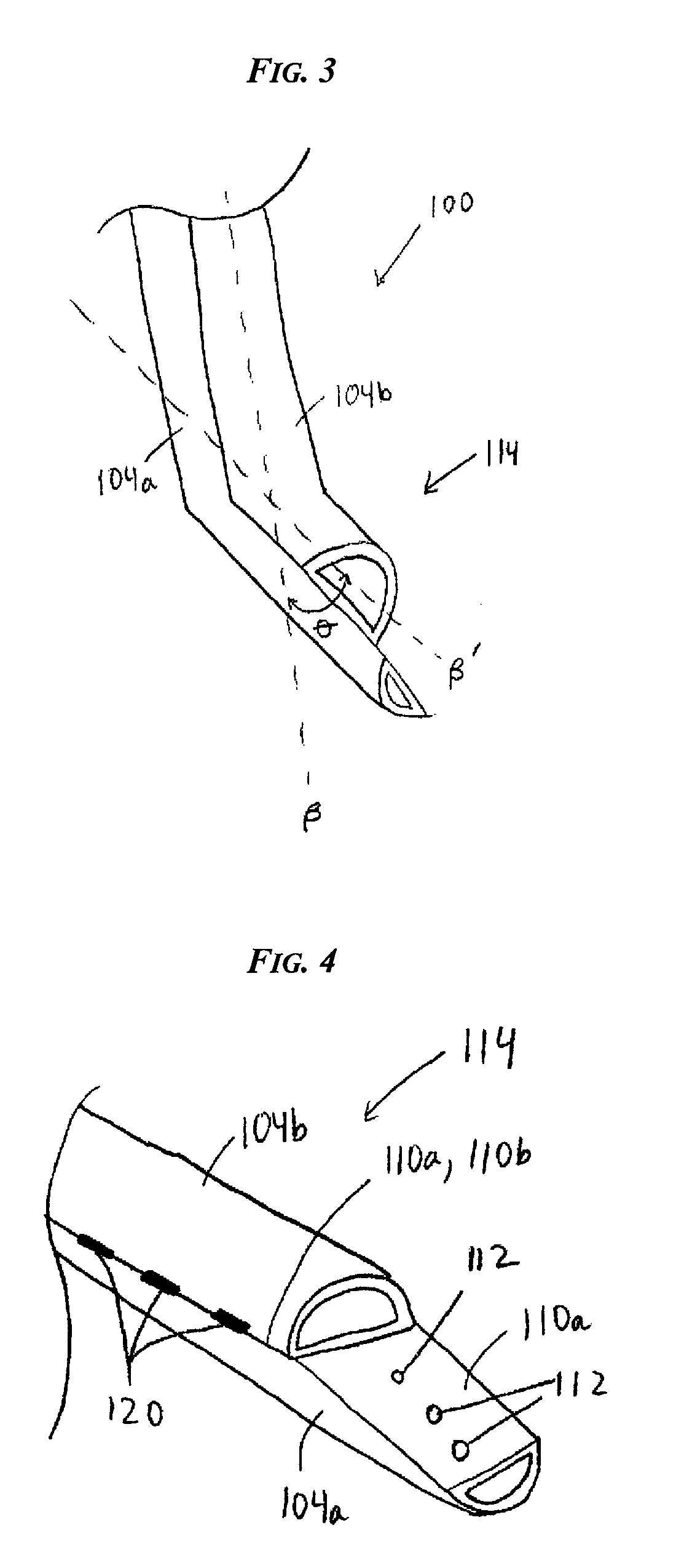 Catheters with enlarged arterial lumens