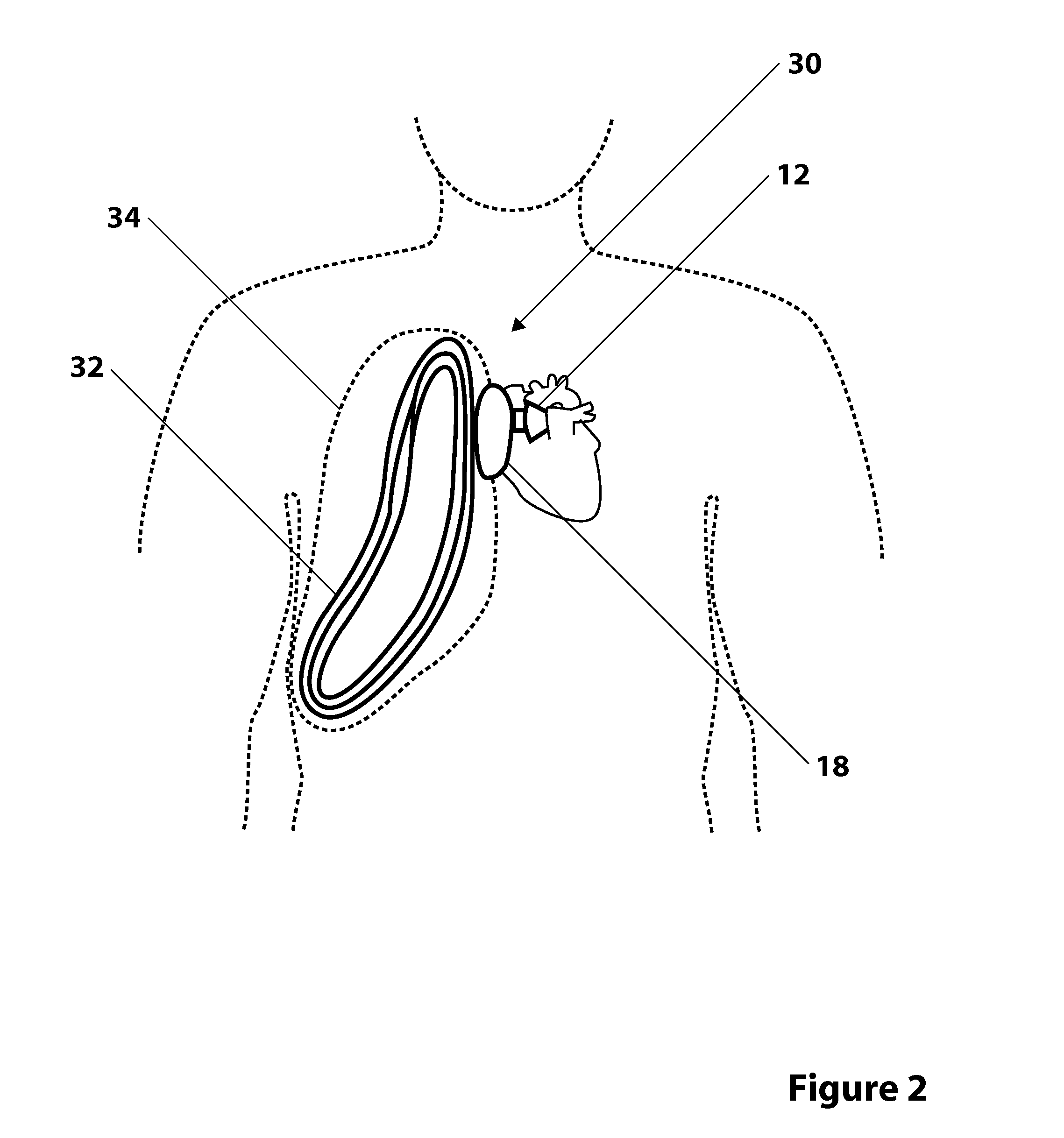 Methods, Systems, and Devices Relating to Wireless Power Transfer