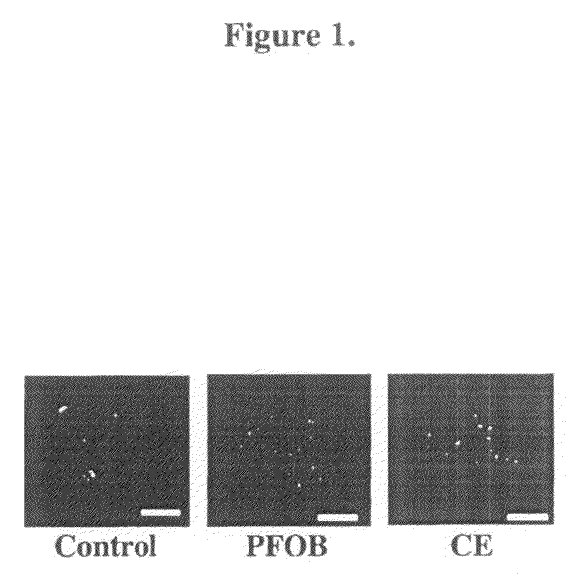 Cell labeling with perfluorocarbon nanoparticles for magnetic resonance imaging and spectroscopy