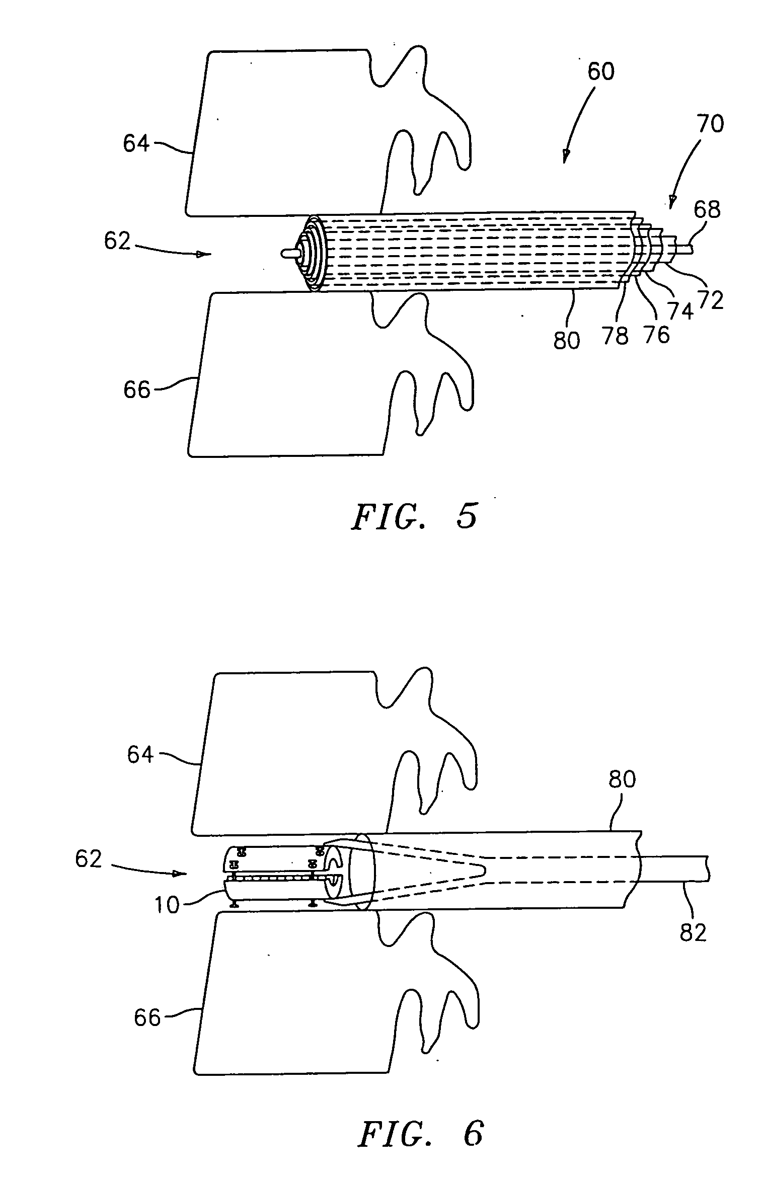 Device and method for lumbar interbody fusion