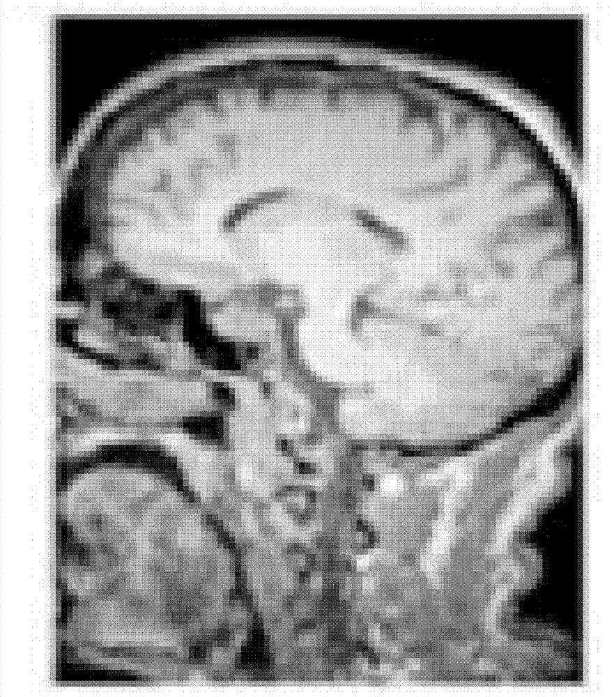 Method and system for determining brain state