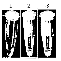 LAMP (Loop-mediated Isothermal Amplification) superbacteria NDM-1 (New Delhi Metallo-beta-lactamase-1) gene as well as kit and method for detecting superbacteria NDM-1 gene