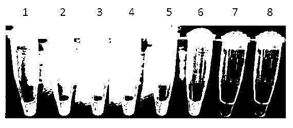 LAMP (Loop-mediated Isothermal Amplification) superbacteria NDM-1 (New Delhi Metallo-beta-lactamase-1) gene as well as kit and method for detecting superbacteria NDM-1 gene