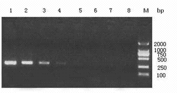 LAMP (Loop-mediated Isothermal Amplification) superbacteria NDM-1 (New Delhi Metallo-beta-lactamase-1) gene as well as kit and method for detecting superbacteria NDM-1 gene