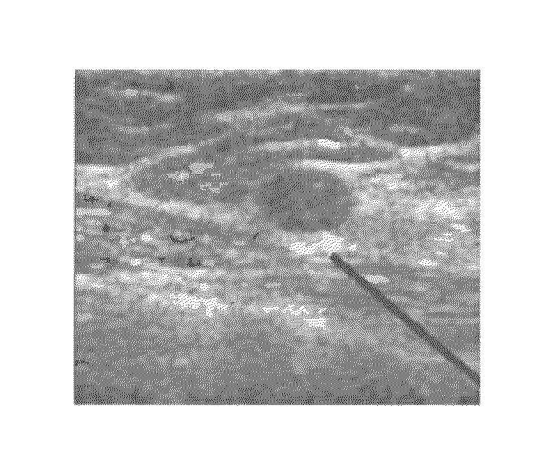 Method, system, and computer software product for feature-based correlation of lesions from multiple images