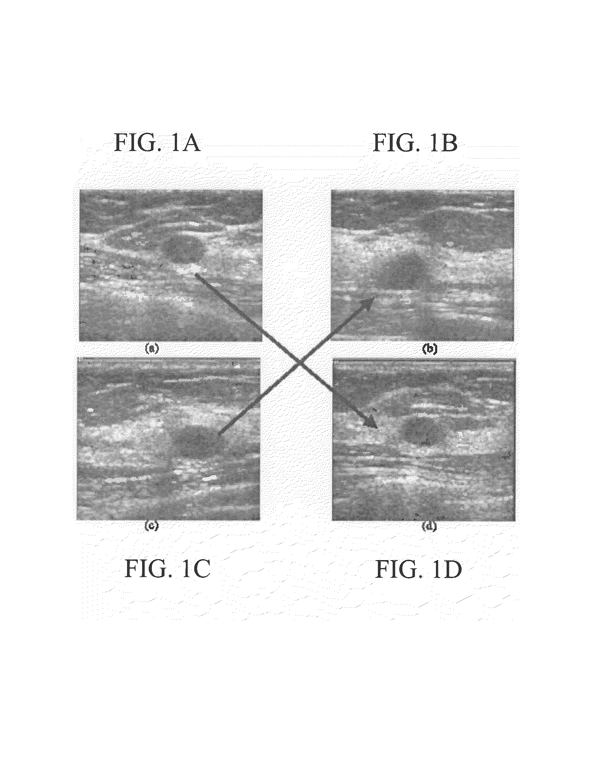 Method, system, and computer software product for feature-based correlation of lesions from multiple images