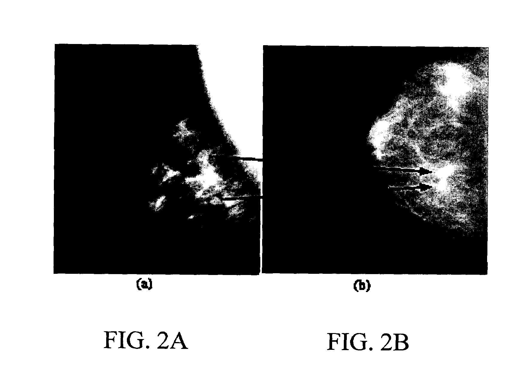 Method, system, and computer software product for feature-based correlation of lesions from multiple images