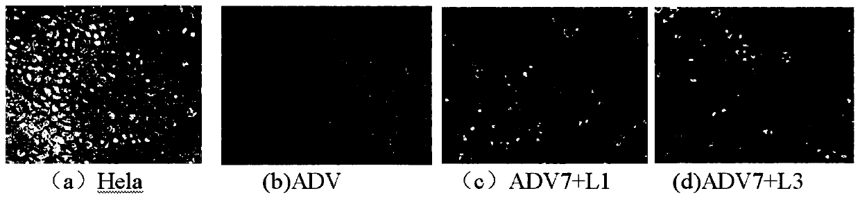 Monoiodobenzoic acid compound and application thereof in resisting ADV7 virus