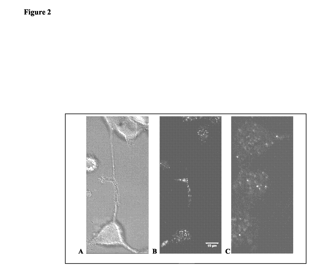 Methods, compositions, diagnostics and assays for the treatment of Alzheimer's disease