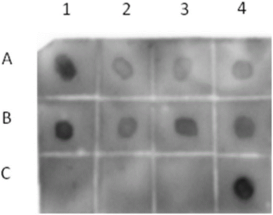 Polypeptide specifically bound with tuberculosis-positive serum and diagnosing kit