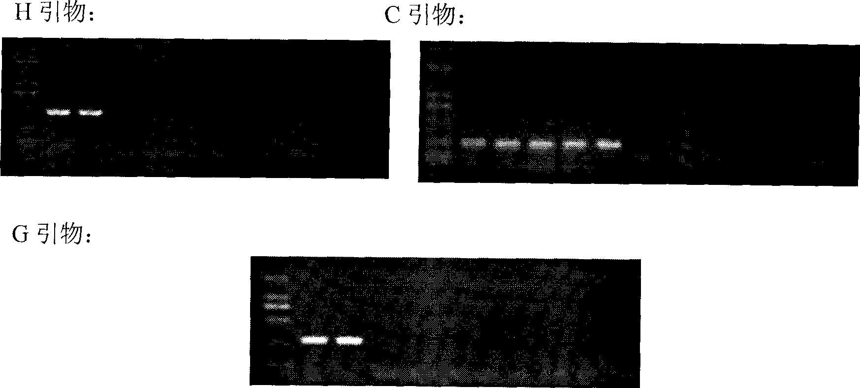 Multi-suspension chip for detecting Cryptosporidium and Giardia lamblia and preparation thereof