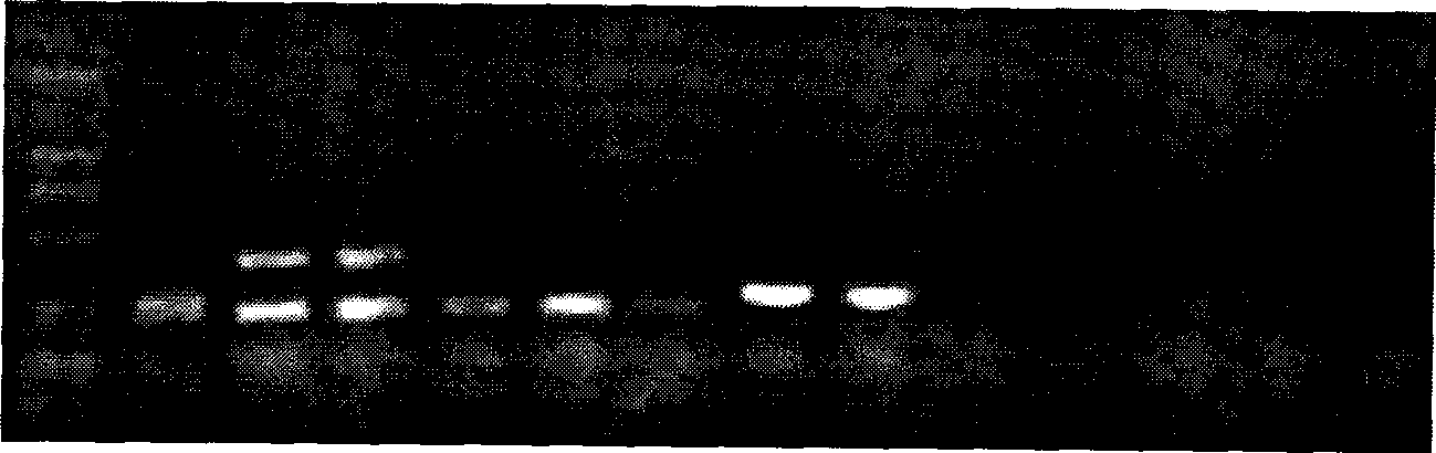 Multi-suspension chip for detecting Cryptosporidium and Giardia lamblia and preparation thereof