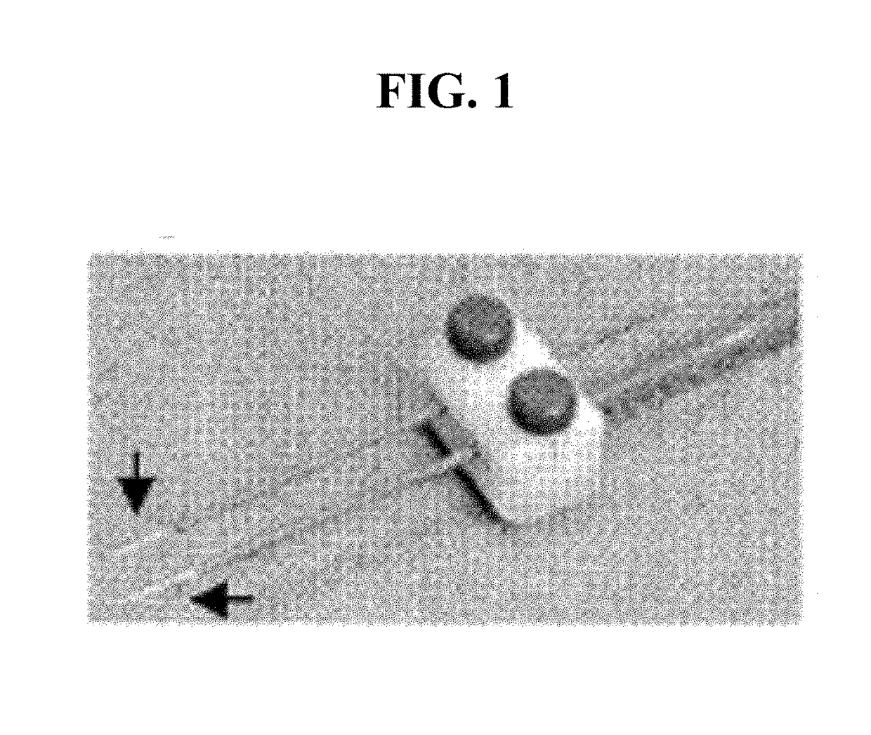 Devices for material delivery, electroporation, sonoporation, and/or monitoring electrophysiological activity