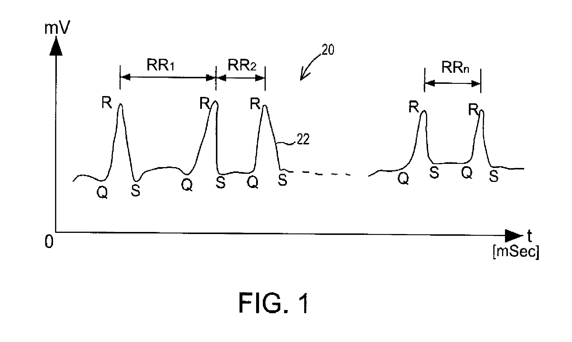 Heart rate variability sensor