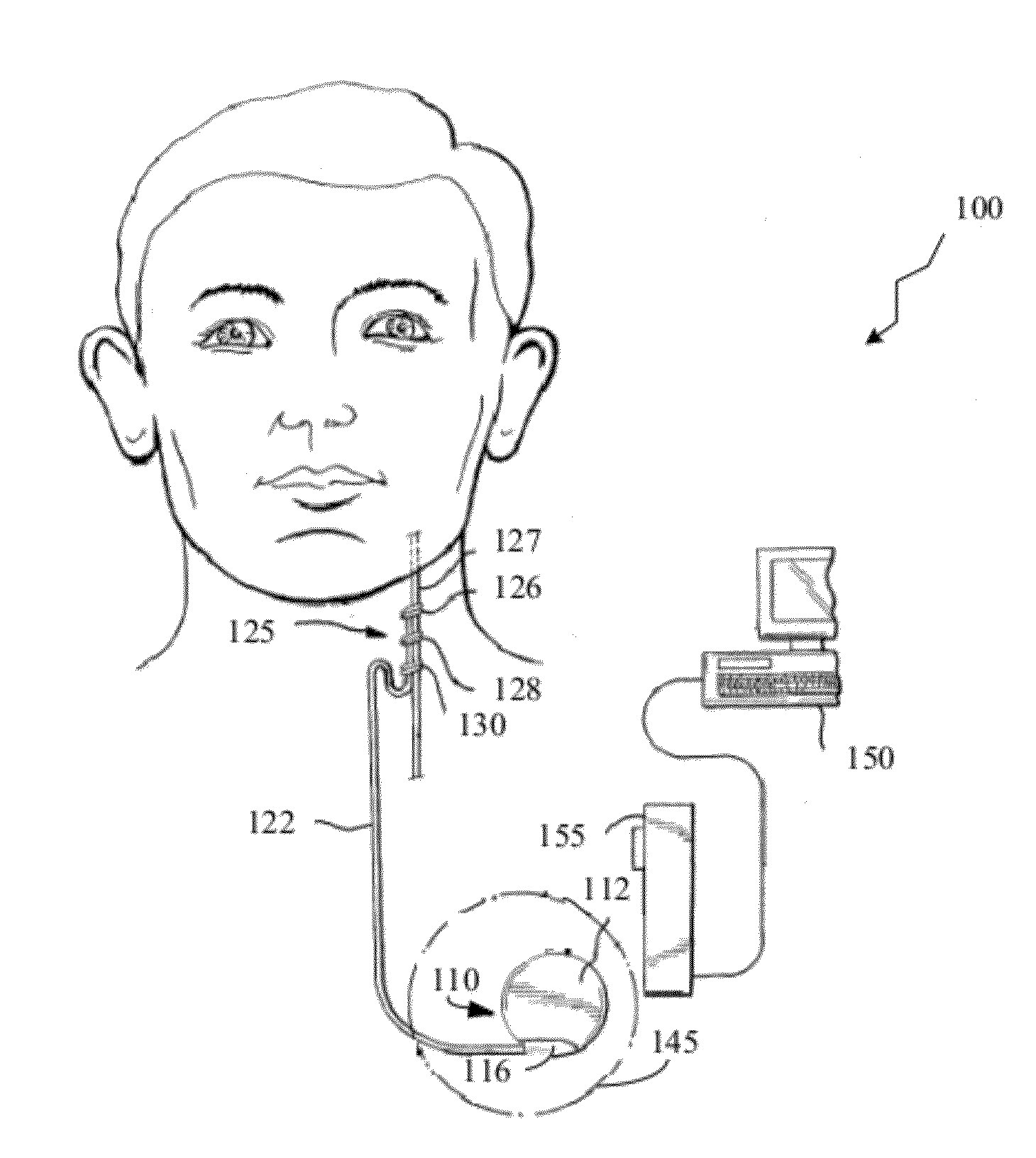 Detecting or validating a detection of a state change from a template of heart rate derivative shape or heart beat wave complex