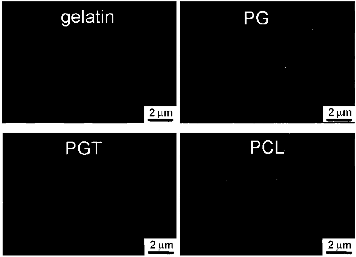 Electrospinning dressing loading growth factor small molecule inhibitor, preparation method and applications thereof