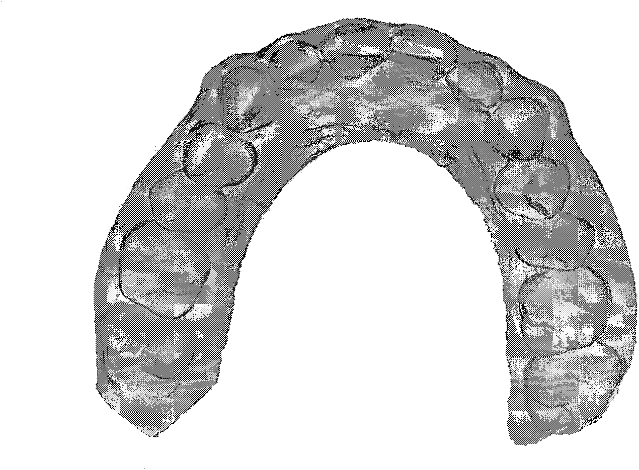 Method suitable for segmenting dental triangle mesh curved surface from dental jaw triangle mesh curved surface