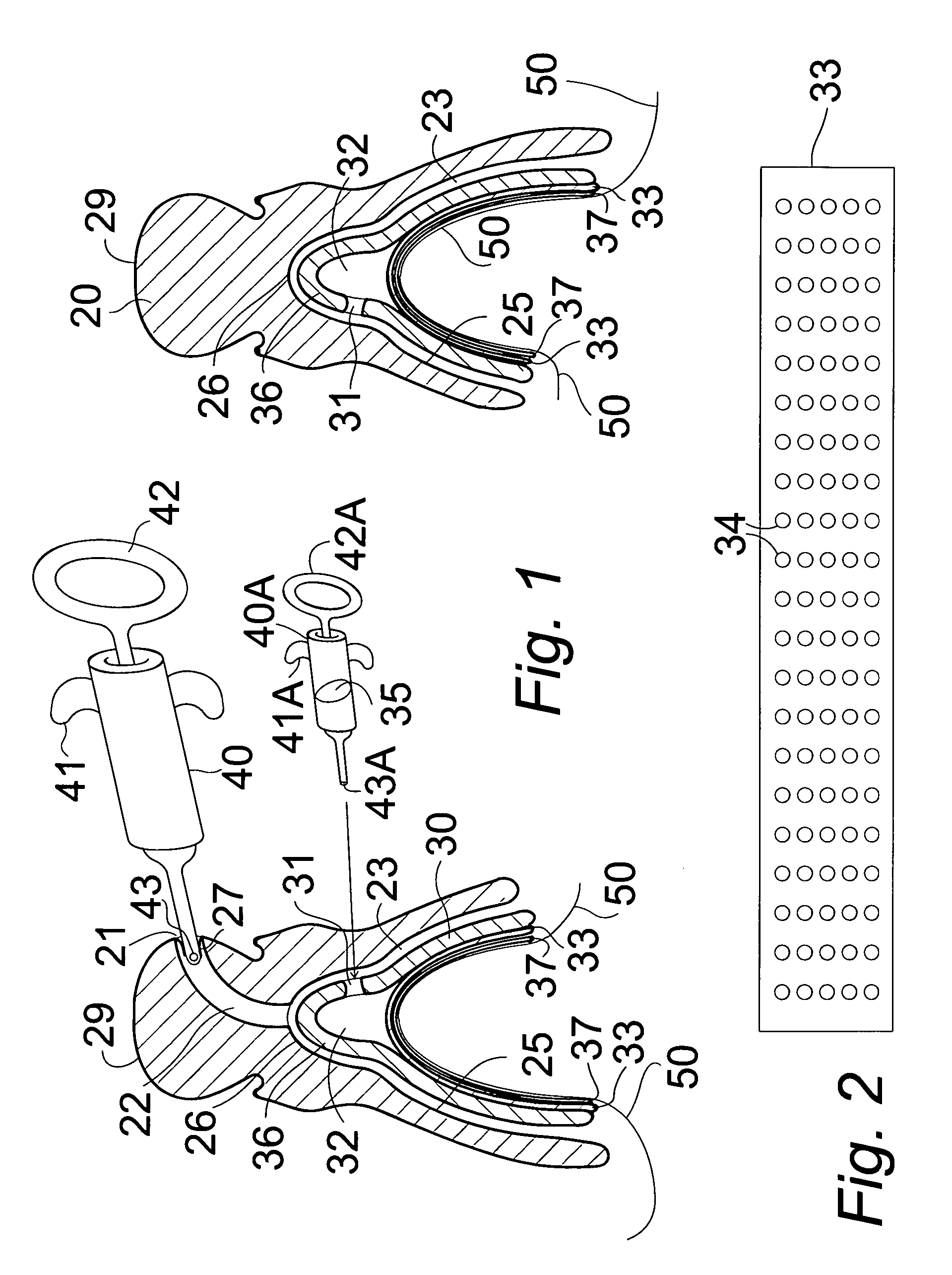 Vacuum-seated dentures with skin contacting plate