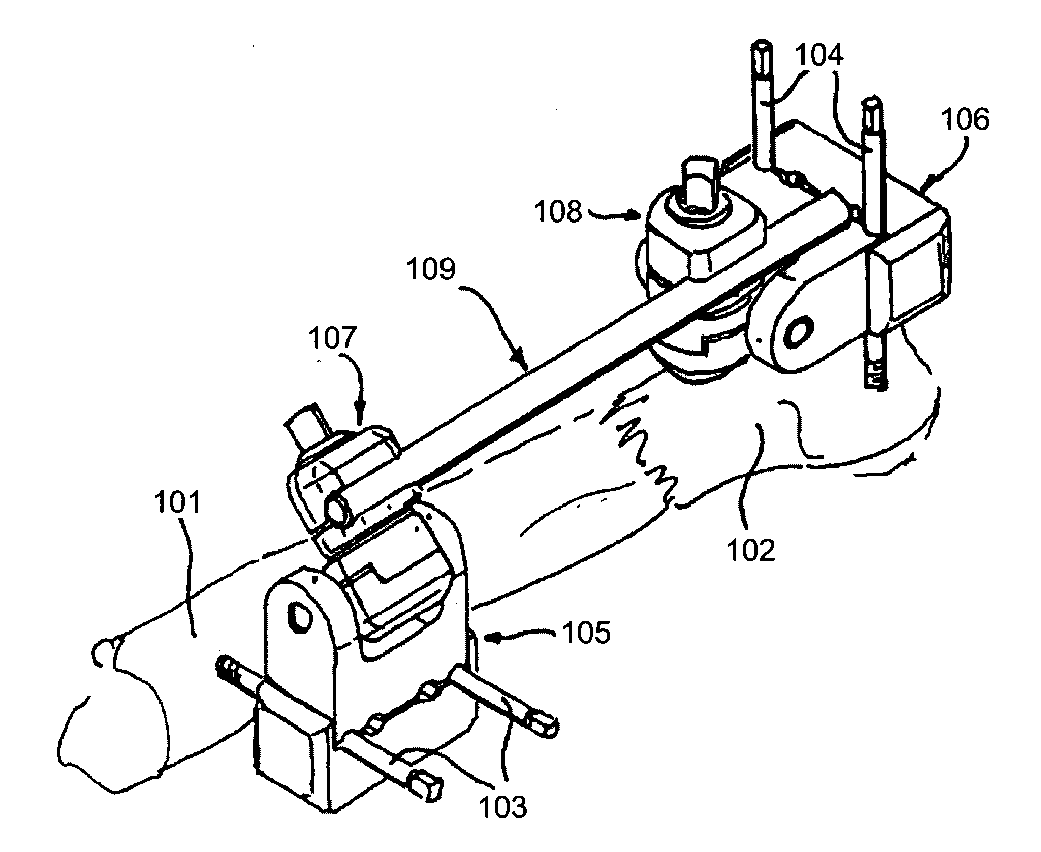 External fixator element