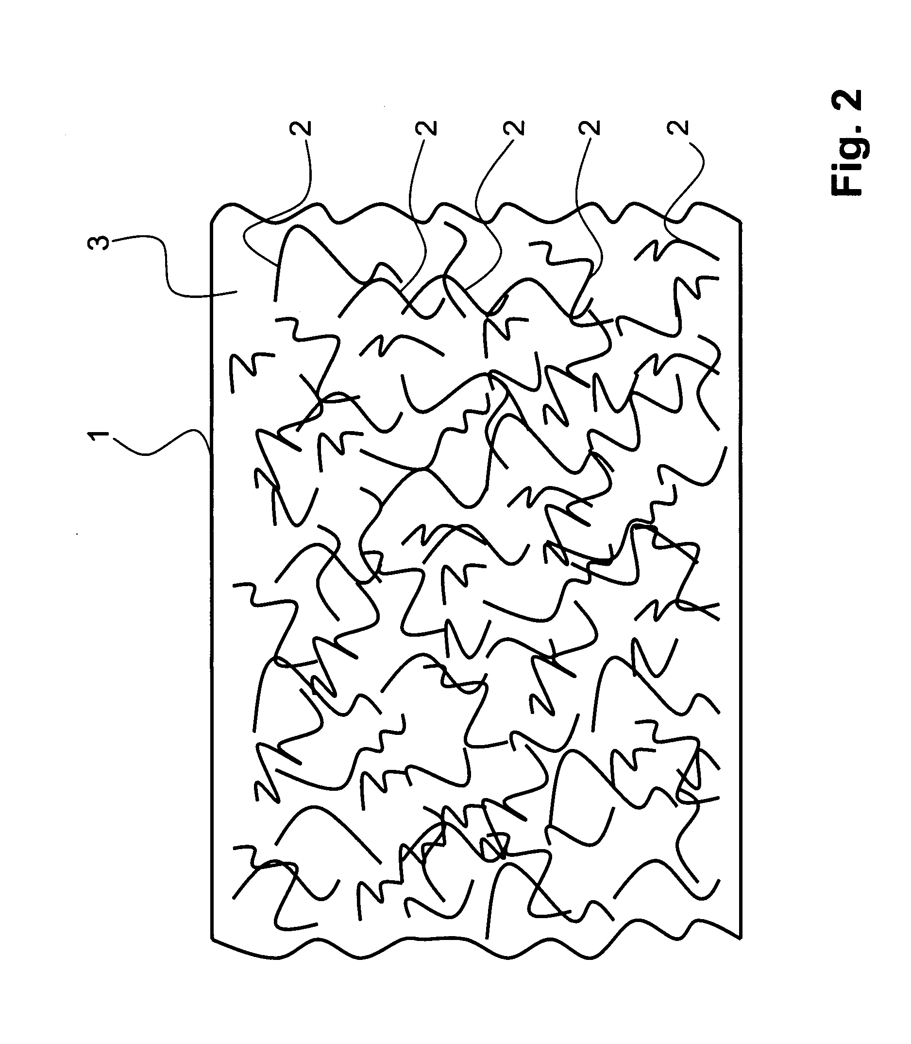 External fixator element