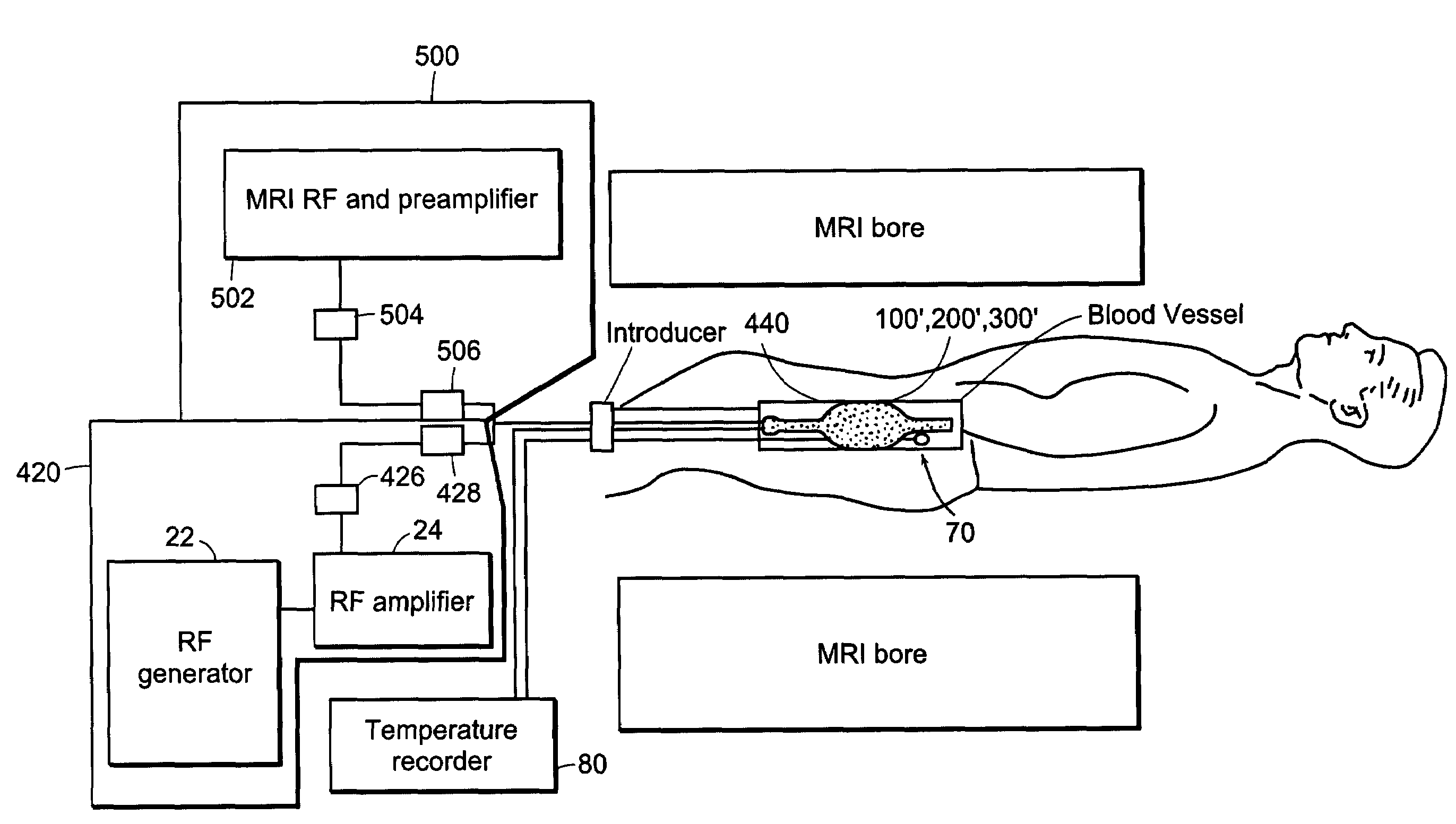 Device, systems and methods for localized heating of a vessel and/or in combination with MR/NMR imaging of the vessel and surrounding tissue