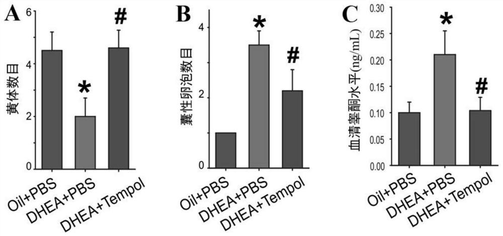 Application of Tempol in preparation of medicine for treating polycystic ovarian syndrome